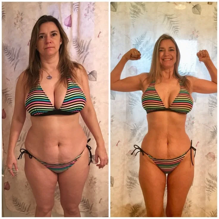 Lisa T. posture transformation